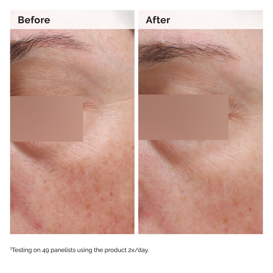 niacinamide-5-face-and-body-emulsion-e7 2024-08-23-ORD-Nia-5pct-Face-Body-B-A-Elasticity-Global-02-1x1.jpg