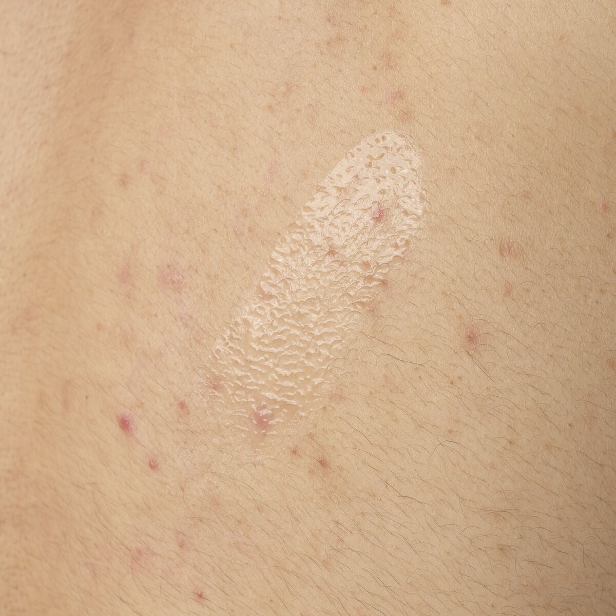 salicylic-acid-0-5-body-serum-z3 ORD-salicylic-acid-05-body-240ml-application.jpg