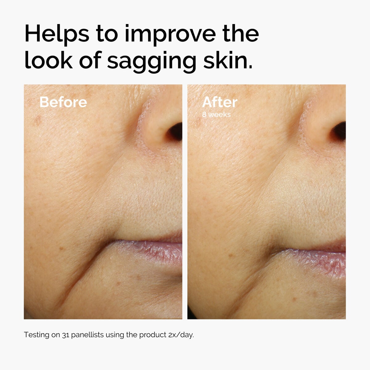 caffeine-3-escin-1-face-serum-x1 ord-caffeine-3pct-escin-1pct-face-serum-before-after-sagging.jpg