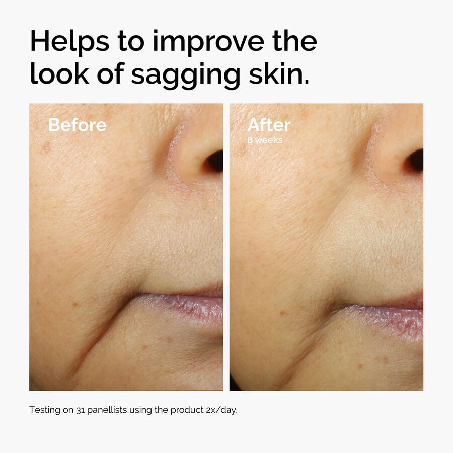 caffeine-3-escin-1-face-serum-x1 ord-caffeine-3pct-escin-1pct-face-serum-before-after-sagging.jpg
