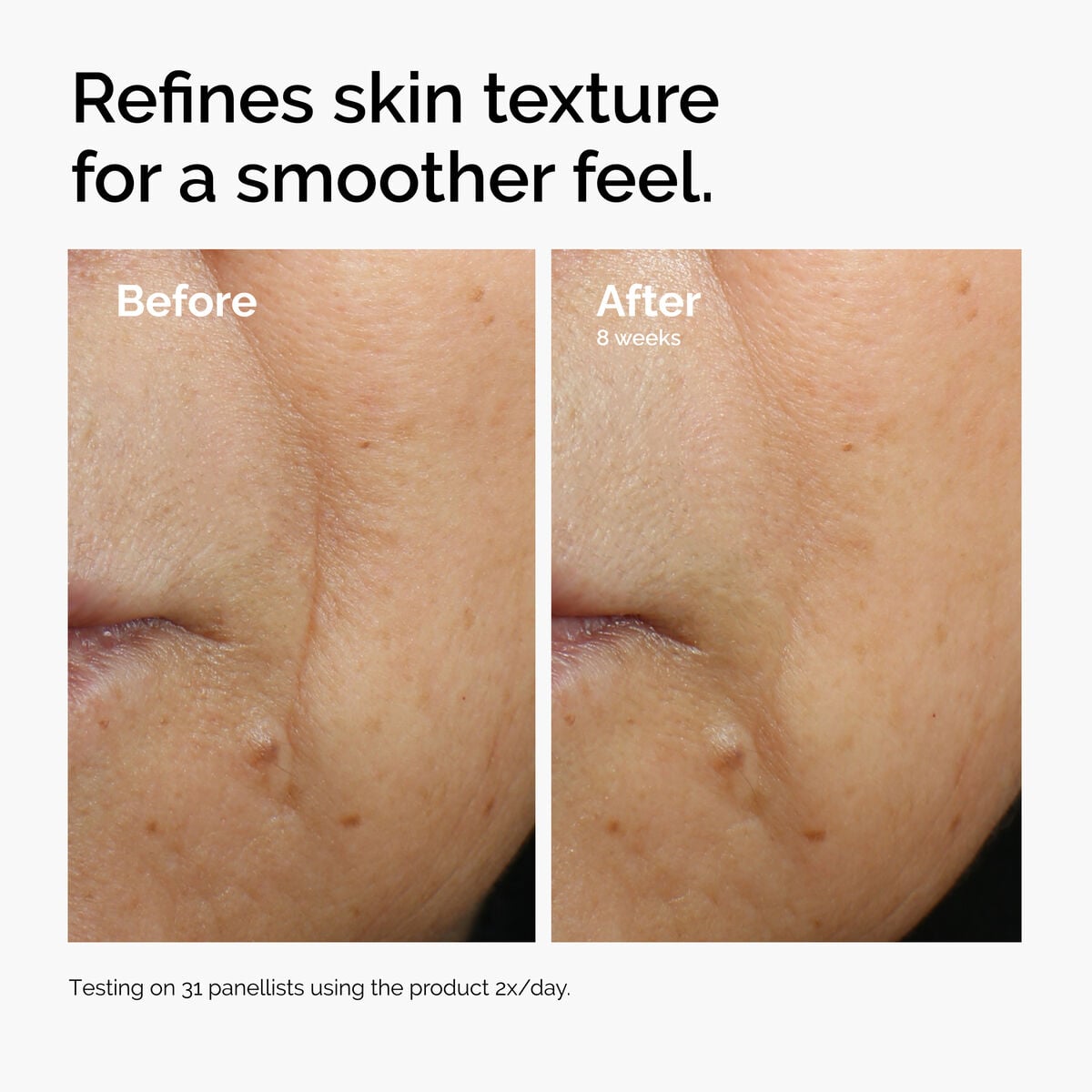 caffeine-3-escin-1-face-serum-x1 ord-caffeine-3pct-escin-1pct-face-serum-before-after-texture.jpg