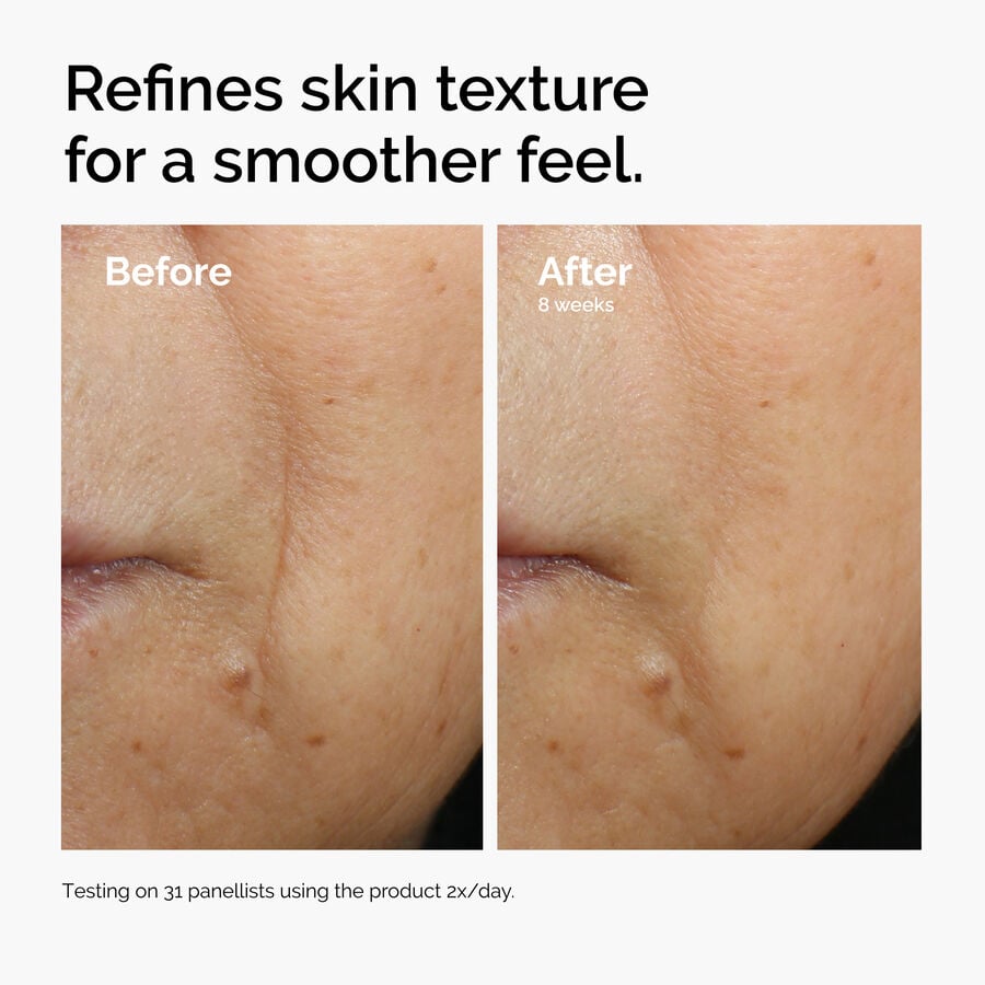 caffeine-3-escin-1-face-serum-x1 ord-caffeine-3pct-escin-1pct-face-serum-before-after-texture.jpg
