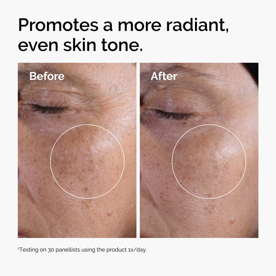glycolic-acid-7-exfoliating-toner-t4 ord-glycolic-before-after-radiance.jpg