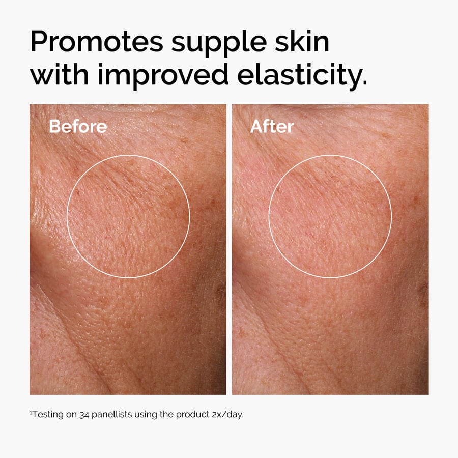 hyaluronic-acid-2-b5-with-ceramides-o1 ord-hyaluronic-acid-2pct-b5-hydrating-serum-before-after-elasticity.jpg