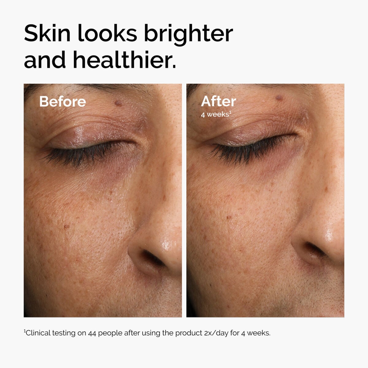 multi-antioxidant-radiance-serum-q3 ord-mars-before-after-healthy.jpg