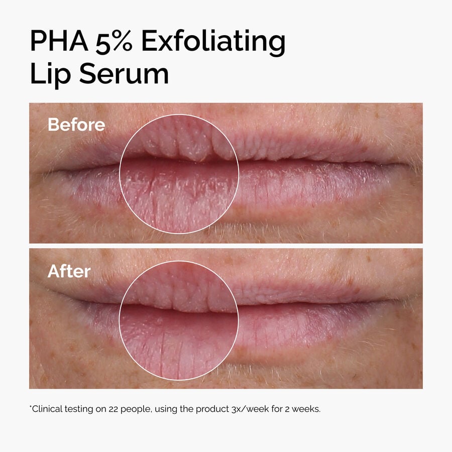 pha-5-exfoliating-lip-serum-e6 ord-pha-5pct-lip-exfoliating-serum-before-after.jpg