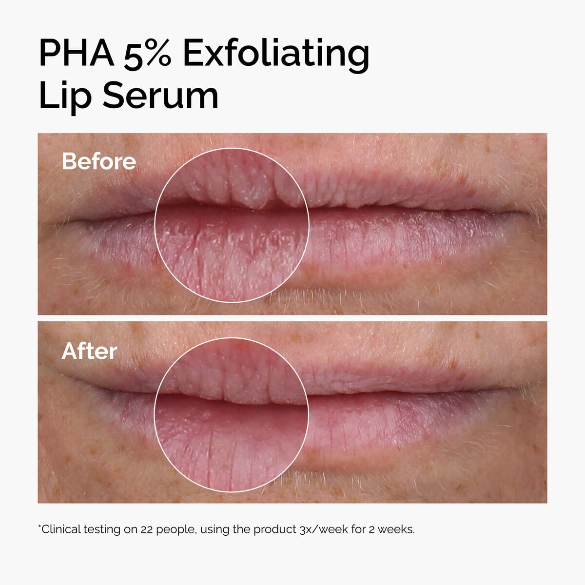 pha-5-exfoliating-lip-serum-i0 ord-pha-5pct-lip-exfoliating-serum-before-after.jpg